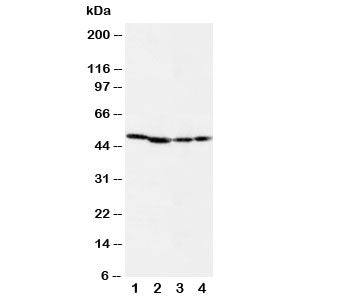 Western blot testing of MEK1 antibody and Lane 1: rat skeletal muscle; 2: rat kidney; 3: (h) CEM; 4: