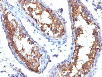 CD99 Antibody