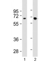 HEXB Antibody / Hexosaminidase B