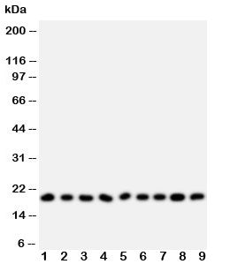 Western blot testing of Ribonuclease A antibody and Lane 1: MCF-7; 2: U87; 3: HeLa; 4: MM231; 5: Jur