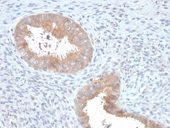 IHC staining of FFPE human uterus with ATG5 antibody. HIER: boil tissue sections in pH 9 10mM Tris w
