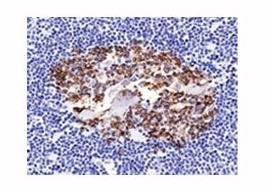 CDw75 Antibody