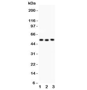 Factor VII Antibody