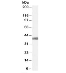 AGTR1 Antibody