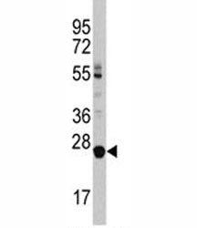 LIN28B Antibody