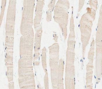 GBA Antibody / Lysosomal acid glucosylceramidase