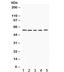 Western blot testing of 1) rat brain, 2) mouse brain, human 3) K562, 4) HeLa and 5) 22RV1 lysate wit