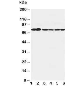 Western blot testing of B Raf antibody and Lane 1: rat brain; 2: rat testis; 3: rat liver; 4: (h) SW
