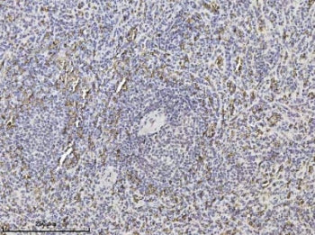 Band 3 Antibody / SLC4A1 / CD233