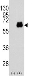 Myc Antibody