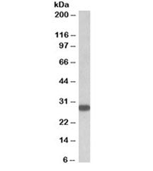 TSHR Antibody