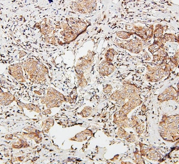 SDHB Antibody