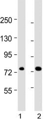 ABCD1 Antibody