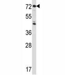 IL-1 Receptor type 1 Antibody