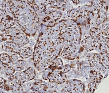 dsDNA Antibody / Double Stranded DNA