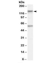 Western blot testing of human Jurkat lysate and CARD11 antibody at 1ug/ml. The expected ~133 kDa ban