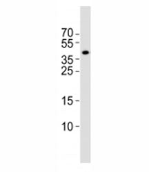 Western blot analysis of lysate from rat brain tissue lysate using Isl1 antibody at 1:1000. Predicte