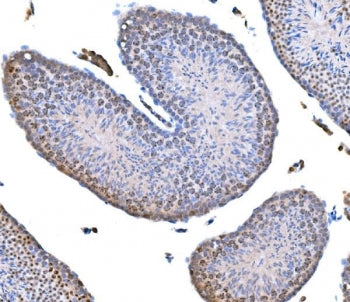 Survivin Antibody
