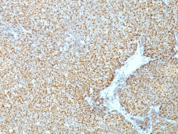 Cyclin D1 Antibody / CCND1