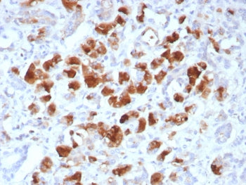 Carboxypeptidase A1 Antibody / CPA1