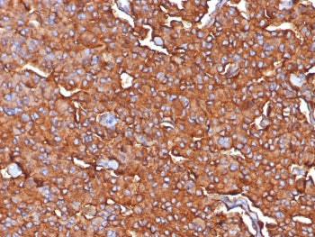 Synaptophysin Antibody
