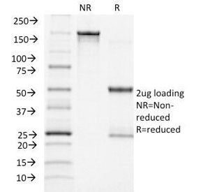 SDS-PAGE Analysis of Purified, BSA-Free ACTH Antibody (clone CLIP/1418). Confirmation of Integrity a