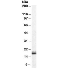 Western blot testing of human ovay lysate with VHL antibody at 0.01ug/ml. Predicted molecular weight