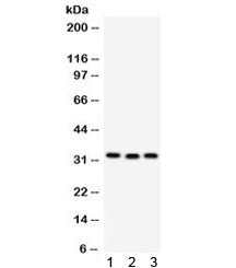 Western blot testing of 1) rat liver, 2) mouse spleen and 3) human MCF7 lysate with C1QBP antibody. 