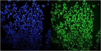 Immunofluorescent staining of FFPE human A431 cells with OGT antibody (green) and DAPI nuclear stain