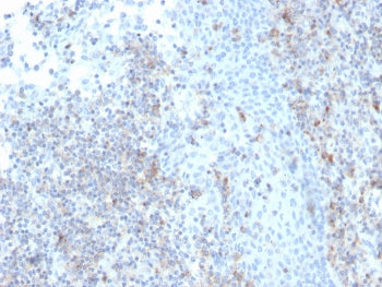 IHC staining of FFPE human tonsil with recombinant CD50 antibody (clone rICAM3/1019). HIER: boil tis