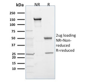 EGLN1 / PHD2 Antibody