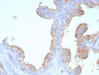 LAMP1 Antibody / CD107A
