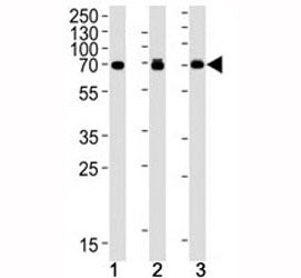 p70 S6 Kinase beta Antibody (RPS6KB2)