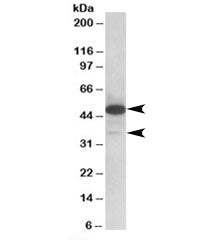 Western blot testing of human lymph node lysate with TXNDC5 antibody at 0.1ug/ml. Isoforms of ~48kDa