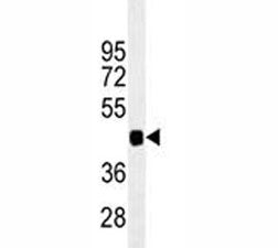 PAX6 Antibody