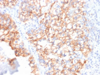 Cadherin 16 Antibody