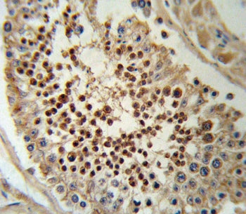 KLF5 Antibody