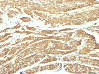 Caldesmon / CAD Antibody HMW