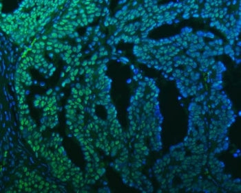 SAP130 Antibody / SF3B3
