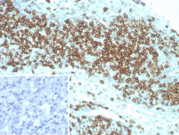 IHC staining of FFPE human lymph node tissue with CD2 antibody (clone LFA2/8845R). HIER: boil tissue