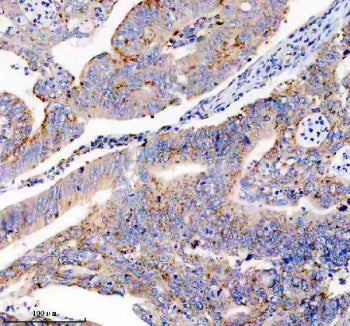 USP14 Antibody / Ubiquitin carboxyl-terminal hydrolase 14, 100ul