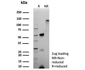 Hemoglobin subunit alpha Antibody / HBA