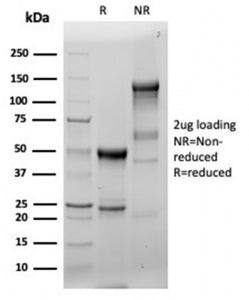 SDS-PAGE analysis of purified, BSA-free recombinant Fascin 1 antibody (clone FSCN1/6465R) as confirm