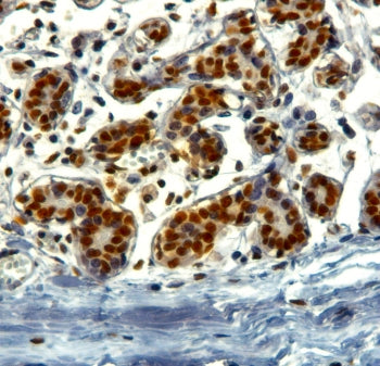 IHC testing of FFPE human breast with TRIM28 antibody at 2ug/ml. HIER: steamed with pH9 citrate buff
