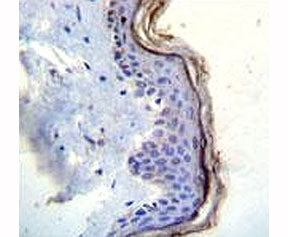 c-Kit Antibody (CD117)