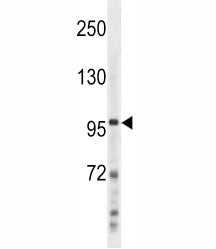 NFKB2 (p100) Antibody