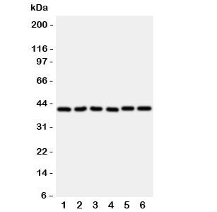 Western blot testing of rat 1) heart, 2) kidney, 3) lung and human 4) A549, 5) A431 and 6) COLO320 l