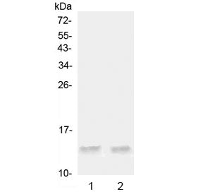 Western blot testing of 1) rat testis and 2) mouse testis tissue lysate with Ccl20 antibody at 0.5ug