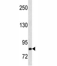 Hepatocyte Growth Factor Antibody (HGF)