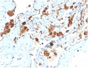 Surfactant protein D Antibody / SFTPD